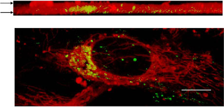 Image: Live RPE cell expressing transfected cystatin C-GFP fusion protein