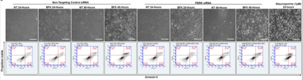 PERK downregulation in RPE cells impairs ER-stress induced apoptosis in a Bax/Bcl-2-dependent manner.